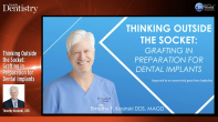 Thinking Outside the Socket: Grafting in Preparation for Dental Implants Webinar Thumbnail