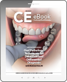 Oral Pathology: Techniques for Detection and Differential Diagnosis eBook Thumbnail