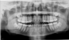 Fig 1. A radiographic assessment may include a panoramic image.