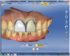 Figure 16 The initial proposal provided acceptable designs, but the width, incisal edge position, and basic outline form did not match.