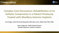 Complex Case Discussions: Rehabilitation of an Esthetic Compromise in a Patient Previously Treated with Maxillary Anterior Implants Webinar Thumbnail