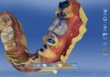 Digitally designed restoration for an edentulous space.