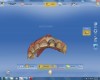 A scan was taken of the tooth No. 9 preparation and added into the old scan in the “Upper Arch” folder.